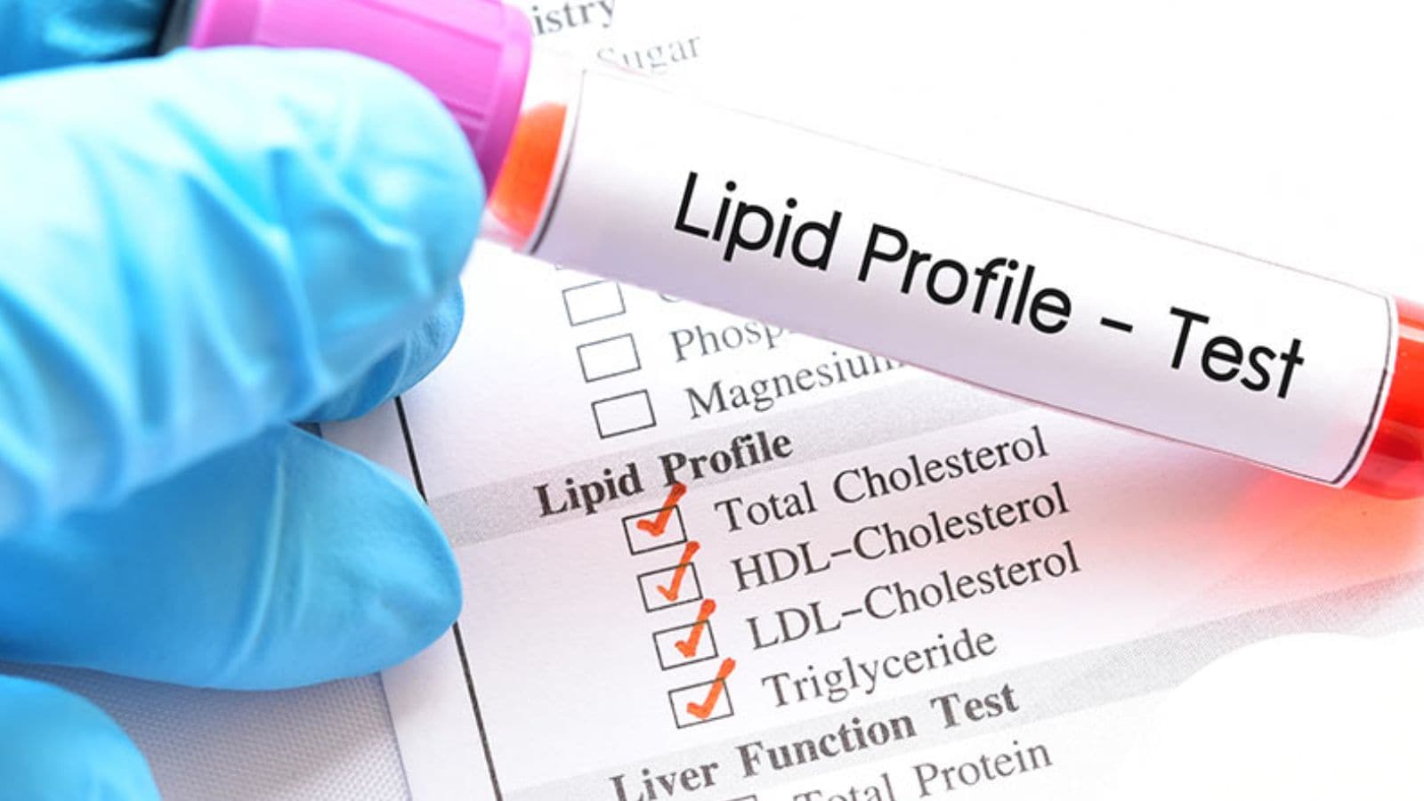 80% இந்தியர்கள் கெட்ட கொலஸ்ட்ராலை அதிகமாக கொண்டிருப்பதே மாரடைப்புக்கு காரணம் - ஷாக் ரிப்போர்ட் தரும் மருத்துவர்கள்..! | Lifestyle News (வாழ்க்கை முறை செய்திகள்) - News18 தமிழ்