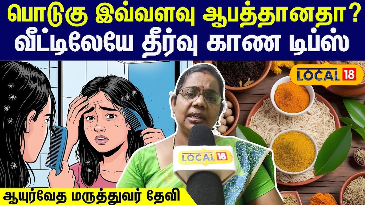 Hair Dandruff solutions : பொடுகு இவ்வளவு ஆபத்தனாதா? வீட்டிலேயே தீர்வு காண டிப்ஸ் | Health Videos (ஆரோக்கியம் வீடியோக்கள்) - News18 தமிழ்