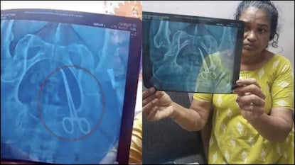 கேரளாவில் சர்ஜரி கத்திரிக்கோல் பெண்ணின் வயிற்றில் வைக்கப்பட்ட அதிர்ச்சி சம்பவம் கேரளாவில் சர்ஜரி கத்திரிக்கோல் பெண்ணின் வயிற்றில் வைக்கப்பட்ட அதிர்ச்சி சம்பவம்