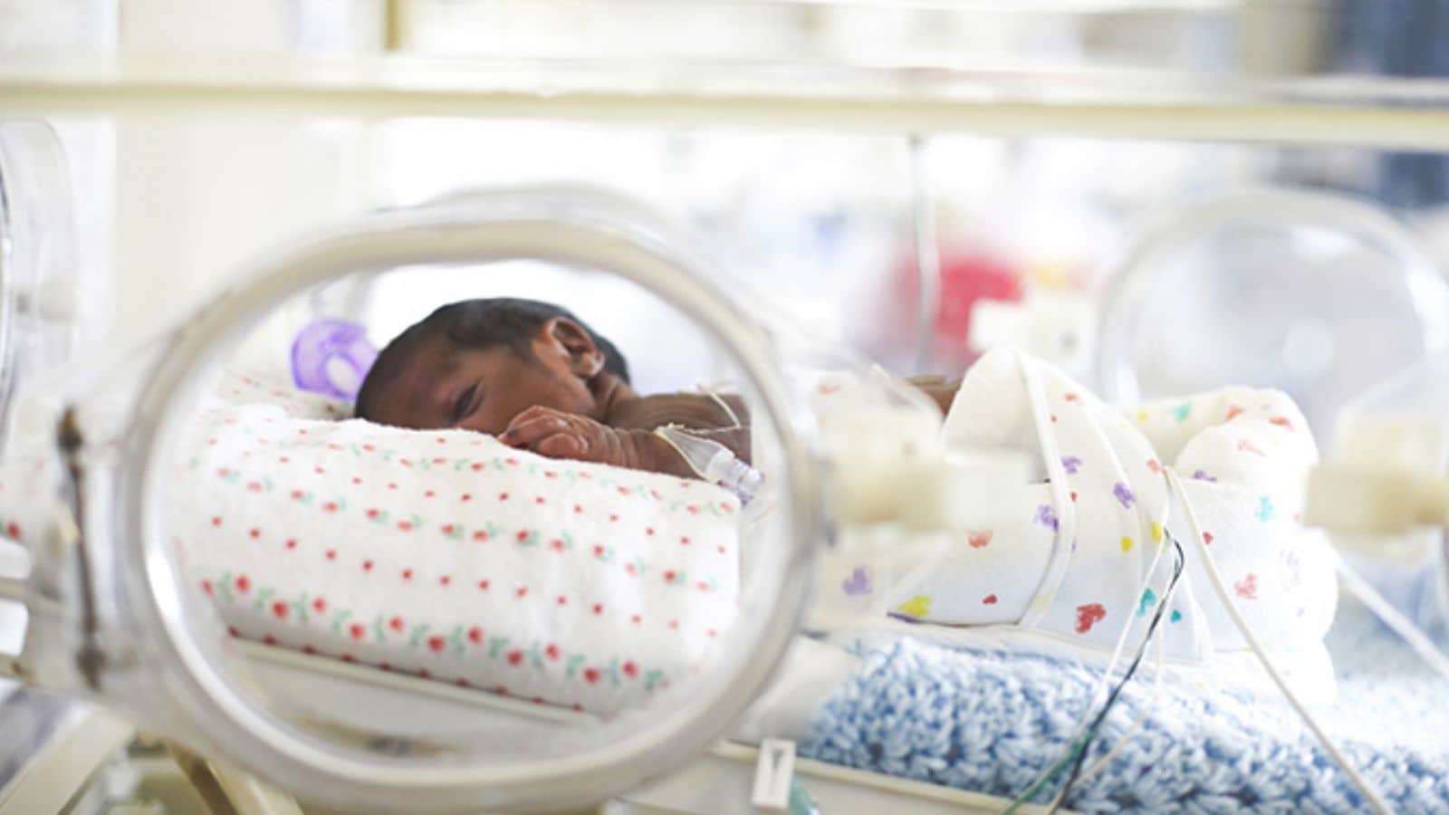 790 கிராம் எடையில் பிறந்த ஆண் குழந்தை - அரசு மருத்துவர்கள் சாதனை | தமிழ்நாடு செய்திகள் (Tamil Nadu News) - News18 தமிழ்