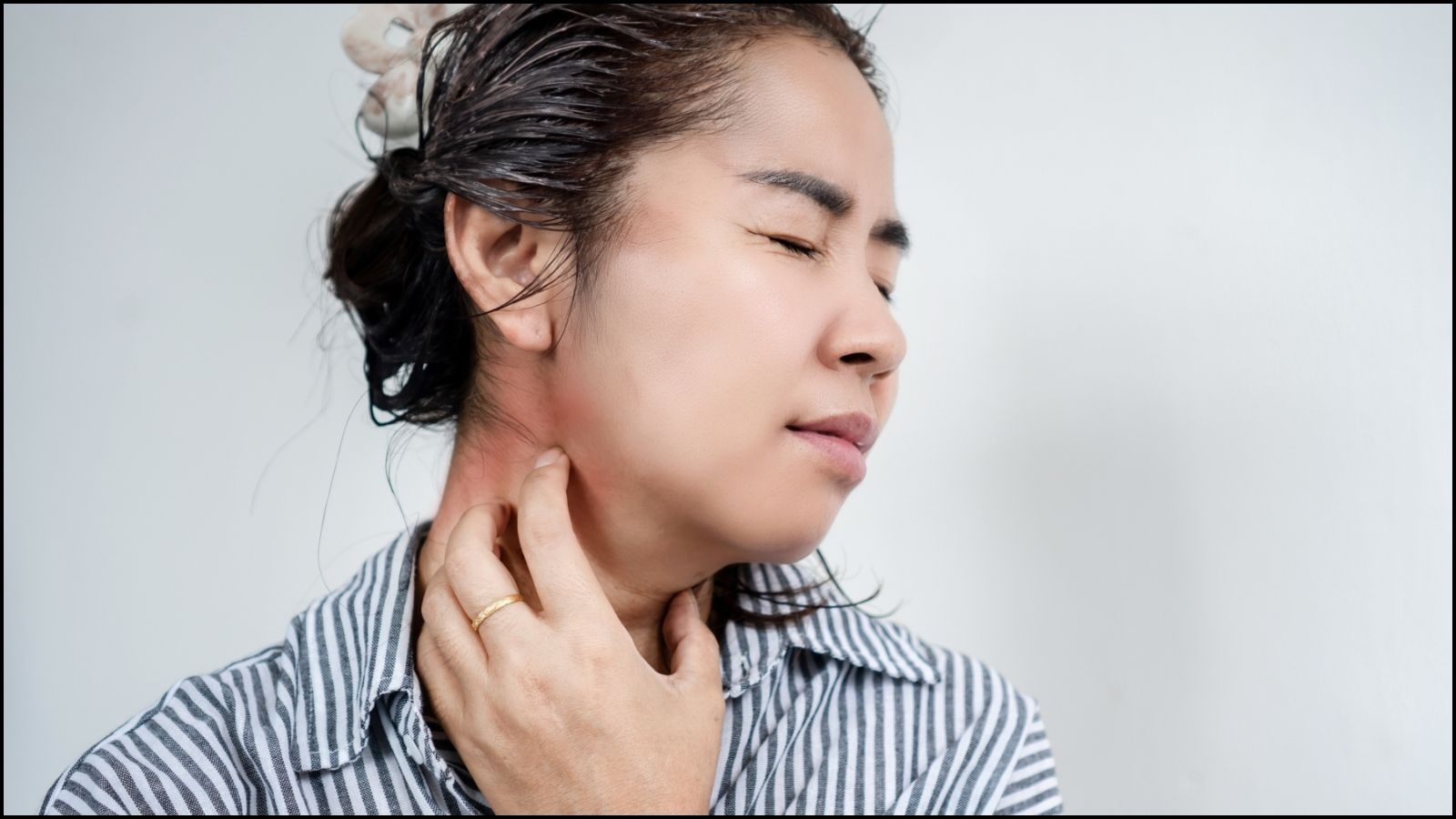 எந்த வைட்டமின் குறைபாட்டால் தோல் அரிப்பு ஏற்படுகிறது? அவசியம் தெரிஞ்சுக்கோங்க! | ஆரோக்கியம் போட்டோகேலரி - News18 தமிழ்