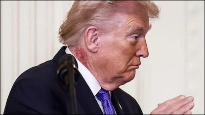 ட்ரம்ப் 