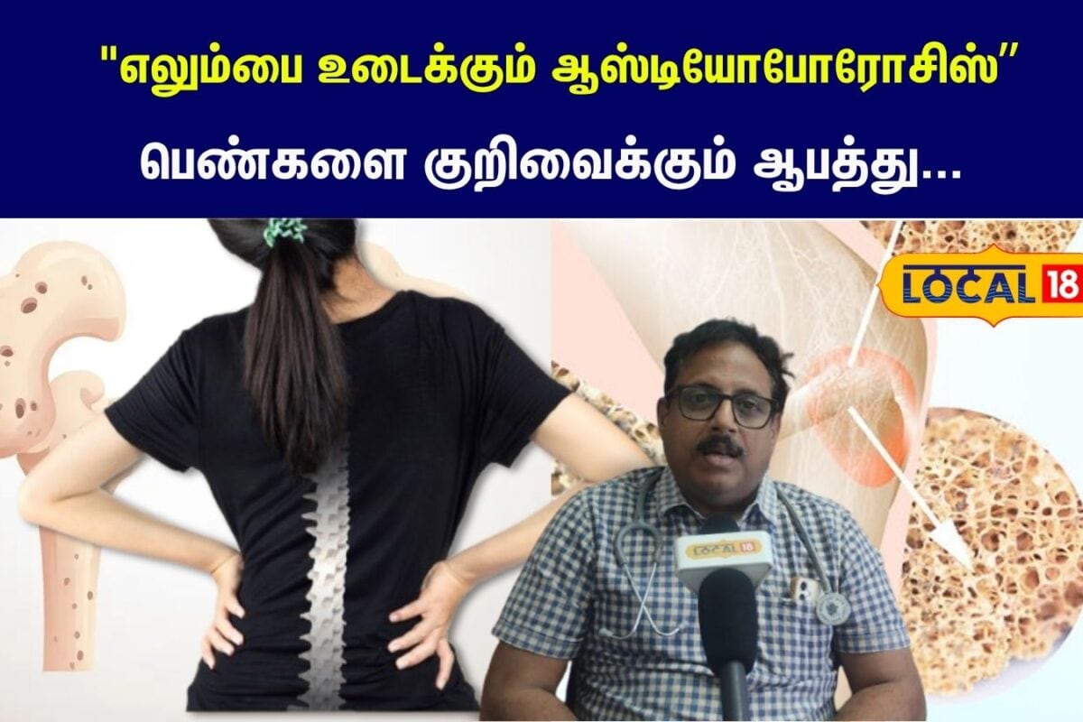 Osteoporosis : எலும்பை உடைக்கும் சைலண்ட் கில்லர்..