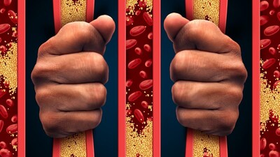 cholesterol