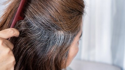 gray hair