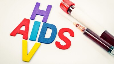 HIV and AIDS