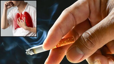 Can Non-Smokers Get Lung Cancer? Do Not Ignore These Symptoms