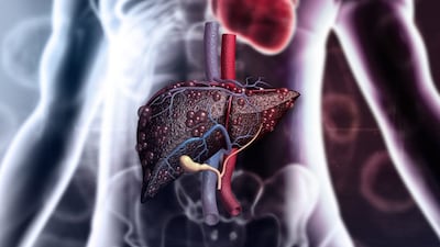 liver health 