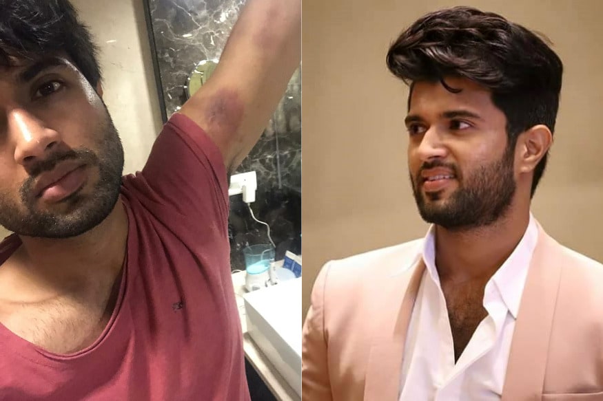 Vijay Devarakonda Marriage proposal.. wants to Marry Kakinada Girl.. ఏంటి విజయ్ దేవరకొండ పెళ్లి చేసుకుంటున్నాడా..? అమ్మో ఈ విషయం తెలిసి ఎంతమంది అమ్మాయిల గుండెలు బెలూన్స్లా పేలిపోతాయో కదా.. ఎందుకంటే ఇప్పుడు విజయ్ దేవరకొండ తెలుగు ఇండస్ట్రీలో మోస్ట్ ఎలిజిబుల్ బ్యాచ్లర్. ఈయన తనకు కాబోయే అమ్మాయి ఎలా ఉండాలో చెప్పాడు. పైగా తనకు ఏ ఊరు అమ్మాయి కావాలో కూడా క్లారిటీ ఇచ్చాడు విజయ్. vijay devarakonda age,vijay devarakonda marriage,vijay devarakonda dear comrade,vijay devarakonda kakinada girl,vijay devarakonda pelli,vijay devarakonda pelli choopulu,vijay devarakonda,telugu cinema,విజయ్ దేవరకొండ,విజయ్ దేవరకొండ పెళ్లి,విజయ్ దేవరకొండ కాకినాడ అమ్మాయి,విజయ్ దేవరకొండ పెళ్లి,విజయ్ దేవరకొండ డియర్ కామ్రేడ్,డియర్ కామ్రేడ్ షూటింగ్,తెలుగు సినిమా