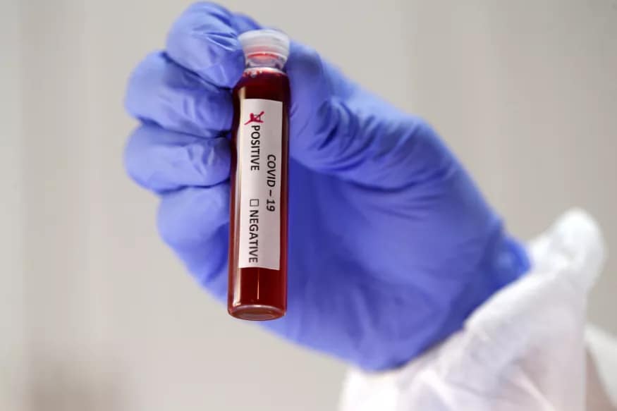 Corona virus cases, ap corona cases, ap covid 19 news, covid 19 andhra Pradesh, corona deaths in andhra Pradesh, ap corona news, ఏపీ కరోనా కేసులు, ఏపీ కోవిడ్ 19, ఏపీలో కరోనా మరణాలు, ఏపీ కరోనా కేసులు
