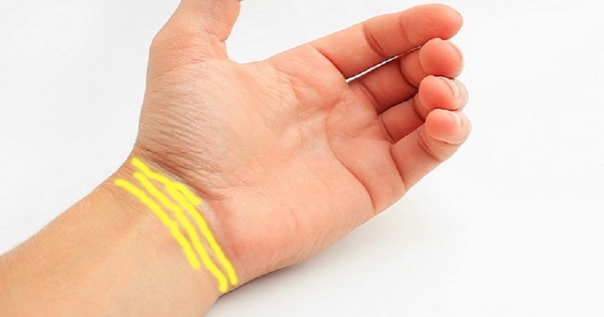  మణికట్టు వైపు గీత… కిందకు పోతూ… అడ్డదిడ్డంగా ఉంటే… ప్రమాదం. అలాంటి గీత ఉన్నవారికి అరిష్టం, చెడు జరుగుతుందని, అశుభాలు కలుగుతాయని పండితులు హెచ్చరిస్తున్నారు. (ప్రతీకాత్మక చిత్రం)