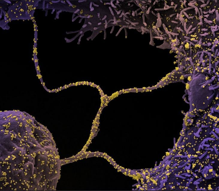 Scientists have studied the corona virus in a total of 21 states. These were conducted in a total of 35 labs. When it comes to Telugu states ... this virus in Telangana ... has changed in 987 ways. In Andhra Pradesh it has become 296 varieties. (image credit - NIAID) Scientists have studied the corona virus in a total of 21 states. These were conducted in a total of 35 labs. When it comes to Telugu states ... this virus in Telangana ... has changed in 987 ways. In Andhra Pradesh it has become 296 varieties. (image credit - NIAID)