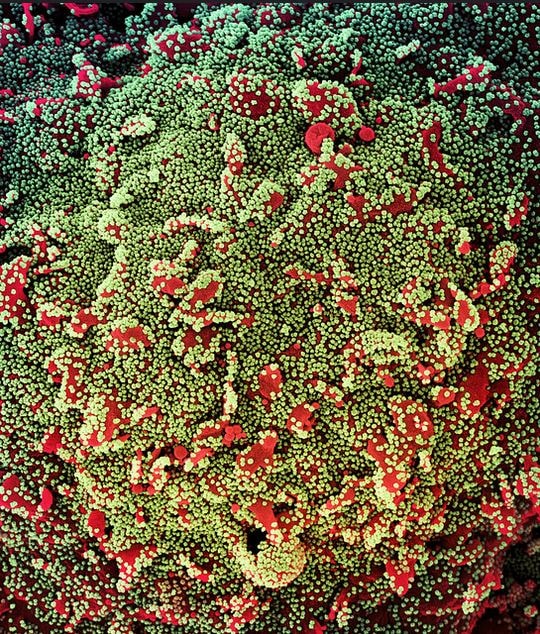 All in all, so far, only two variants of the corona virus, E484K and N501Y, have been reported in the world. They want to do in-depth research to find out how far they are in India. (image credit - NIAID) All in all, so far, only two variants of the corona virus, E484K and N501Y, have been reported in the world. They want to do in-depth research to find out how far they are in India. (image credit - NIAID)