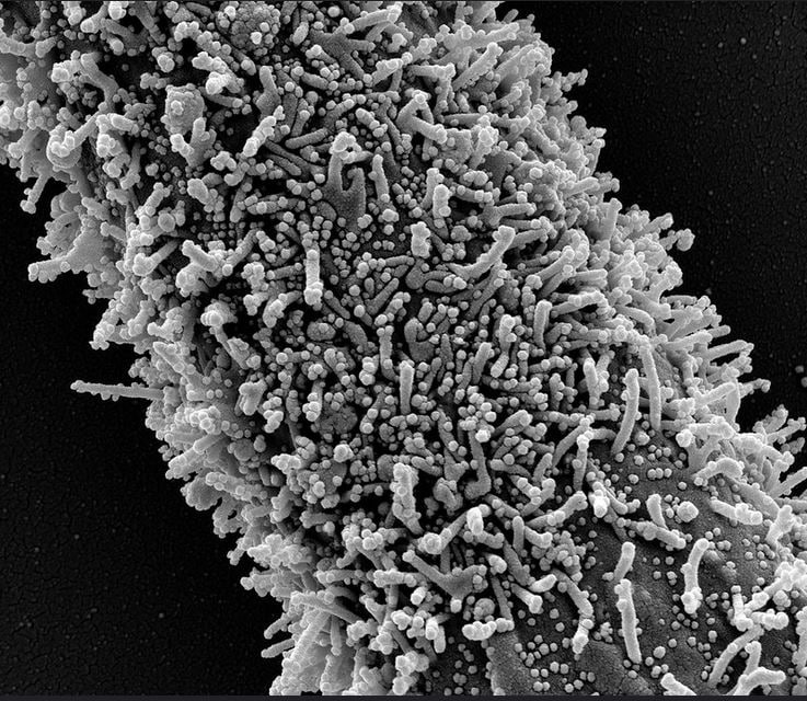 When this corona arrived in China ... our CCMB scientists became very busy. So much so that ... they themselves have done research on over 5,000 corona mutation viruses and made reports. What a great thing. It is difficult to see such a small virus under a microscope. Seeing that ... recognizing what kind of it is ... calculating ... it is difficult to put into words. (image credit - NIAID) When this corona arrived in China ... our CCMB scientists became very busy. So much so that ... they themselves have done research on over 5,000 corona mutation viruses and made reports. What a great thing. It is difficult to see such a small virus under a microscope. Seeing that ... recognizing what kind of it is ... calculating ... it is difficult to put into words. (image credit - NIAID)