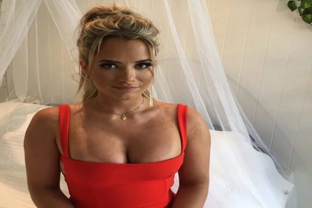  ప్రస్తుతం టిల్లీ... క్లే ఫేస్ మాస్క్ ద్వారా... తన మచ్చలను తగ్గించుకునేందుకు ప్రయత్నిస్తోంది. మొదటిసారి ఆస్ట్రేలియా బిగ్ బ్రదర్ హౌస్‌లో అడుగుపెట్టిన ఈ బ్యూటీ... వీలైనంతవరకూ మౌనంగా ఉంటాననీ... తెలివిగా గేమ్ ఆడతానని తెలిపింది. (image Credit - Instagram - tillywhitfeld)