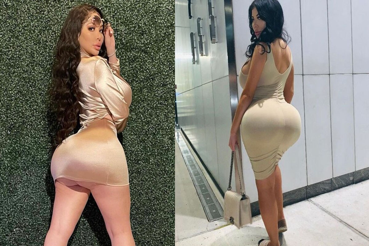  స్టెఫానీ పాలొమార్స్... వయసు 27 ఏళ్లు. నివసించేది అమెరికాలోని లాస్ వెగాస్‌లో. ఇప్పుడీమె వార్తల్లోకి ఎక్కింది. ఎందుకంటే... ఈమె తన సీటు సైజును బాగా పెంచుకోవడానికి ప్రత్యేక ఆపరేషన్ చేయించుకుంది. ఇందుకోసం రూ.1.5 కోట్లు ఖర్చు పెట్టింది. దాంతో వెనక భాగం బాగా పెరిగిపోయి... ప్రత్యేకంగా కనిపిస్తోంది. ఆమె కోరుకున్నది కూడా అదే. తనను ఎవరు చూసినా... ముందుగా వెనకే చూడాలని ఆమె కోరుకుంది. తనను చూసిన వాళ్లు ఆశ్చర్యపోయి నోరెళ్లబెట్టాలన్నది ఆమె కోరిక. ఈ ఆపరేషన్ వెనక ఓ భారీ బిజినెస్ ప్లాన్ ఉంది. అదేంటో తెలుసుకుందాం. (image credit - instagram - stephaniepalomares_)