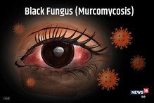 AP Black Fungus Cases: ఏపీలో బ్లాక్ ఫంగస్ పెరగడానికి కారణం ఇదేనట.. పొరపాటున ఇలా చేయకండి..