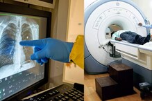CT scan: కరోనా సోకిందేమోనన్న భయంతో సీటీ స్కాన్ చేయించుకుంటున్నవారికి షాకింగ్ న్యూస్..!