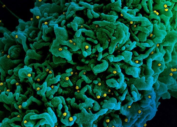  అయితే చాలా దేశాలతో పోలిస్తే ఈ దేశాల్లో వైరస్‌ ఉద్ధృతి తక్కువగానే ఉందని అంటున్నారు. ఛాద్‌లో ఇప్పటివరకు 170 మందే కరోనా కారణంగా మృతి చెందారట. అయితే ఇది అధికారిక లెక్కలు మాత్రమే అని సమాచారం. అక్కడ నమోదుకాని కేసుల సంఖ్య భారీ స్థాయిలో ఉంటుందనే వాదనలూ వినిపిస్తున్నాయి.