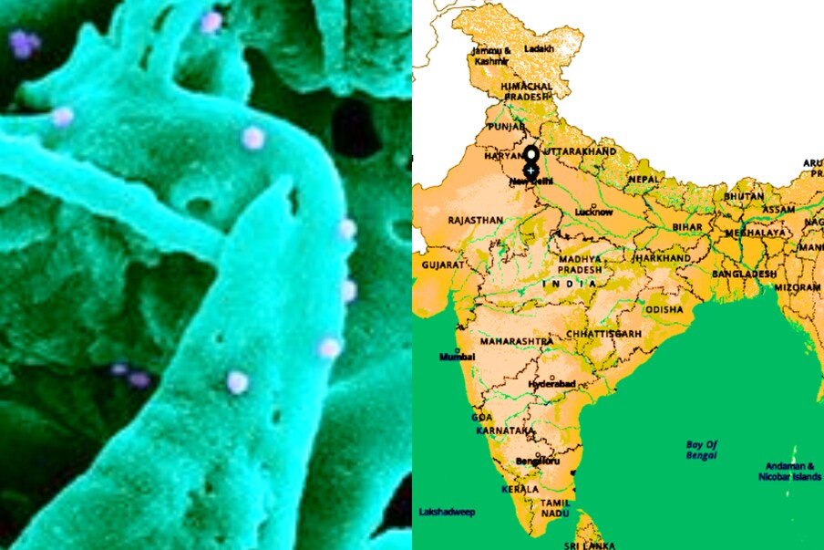  Covid 19 Updates: ఇండియాలో కొత్తగా 53,256 కేసులు వచ్చాయి. మొత్తం కేసుల సంఖ్య 2,99,35,221కి చేరింది. కొత్తగా 1,422 మంది మరణించారు. మొత్తం మరణాల సంఖ్య 3,88,135కి చేరింది. దేశంలో మరణాల రేటు 1.3 శాతంగా ఉంది. ప్రపంచదేశాల్లో ఇది 2.17 శాతంగా ఉంది. ఇండియాలో తాజాగా 78,190 మంది కరోనా నుంచి కోలుకున్నారు. మొత్తం రికవరీల సంఖ్య 2,88,44,199కి చేరింది. రికవరీ రేటు కొద్దిగా పెరిగి 96.4 శాతానికి చేరింది. ప్రస్తుతం భారత్‌లో 7,02,887 యాక్టివ్ కేసులు ఉన్నాయి. దేశవ్యాప్తంగా కొత్తగా 13,88,898 టెస్టులు చేశారు. భారత్‌లో ఇప్పటివరకు 39 కోట్ల 24 లక్షల 07 వేల 782 టెస్టులు చేశారు. కొత్తగా 30,39,996 మందికి వ్యాక్సిన్లు వేశారు. ఇప్పటివరకు 28 కోట్ల 36 వేల 898 మంది వ్యాక్సిన్ వేయించుకున్నారు. (image credit - NIAID)