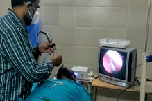 Corona Test: కరోనా టెస్టు చేస్తుండగా.. ముక్కులోనే విరిగిన పుల్ల.. తర్వాత ఏమైందంటే..