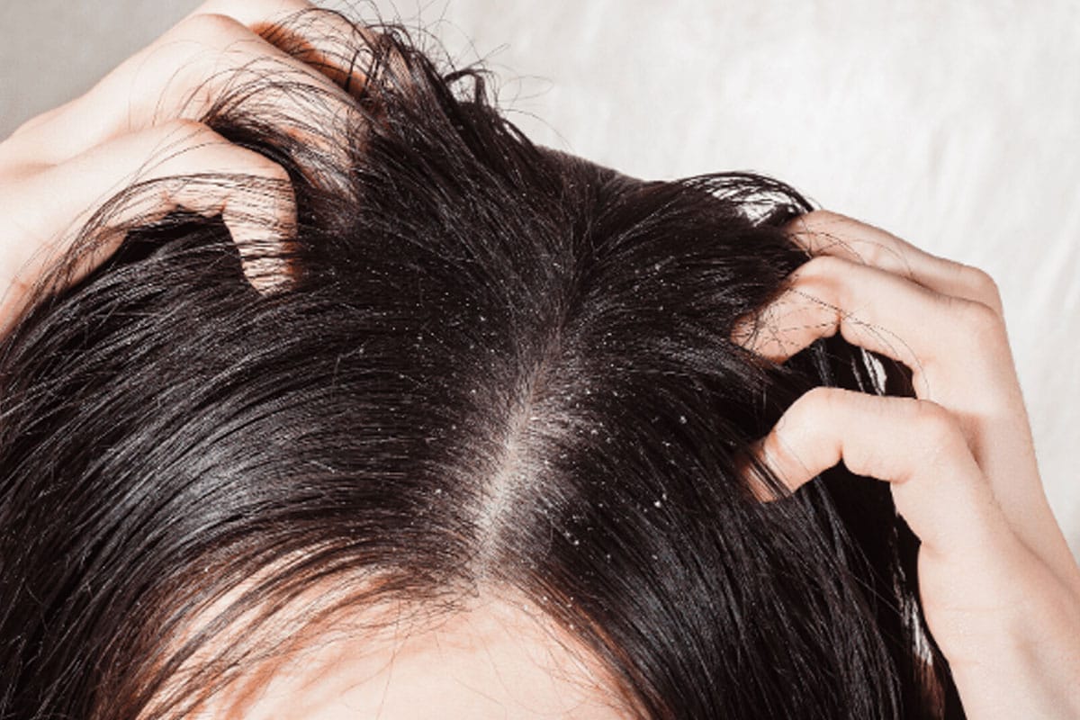 10 Ways to Treat Dry Frizzy Hair at Home According to Stylists