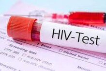 HIV నివారణపై శాస్త్రవేత్తల ముందడుగు.. ఎయిడ్స్ ఔషధ తయారీ మరింత సులభం...