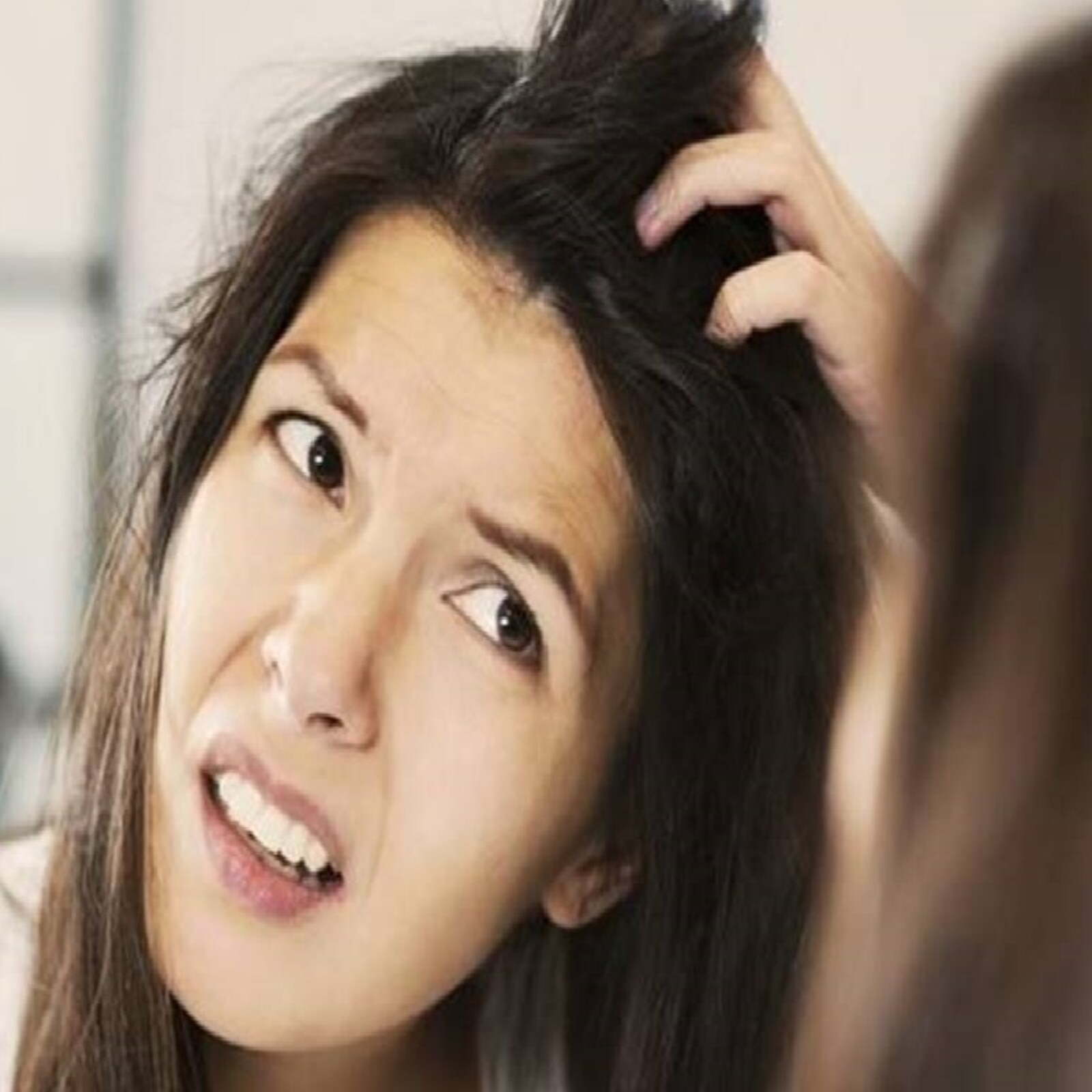 dandruff home remedies in telugu: మీ జుట్టులో డాండ్రఫ్ ఎక్కువగా వస్తోందా? అయితే ఈ సింఫుల్ టిప్స్ ఫాలో అవండి.. చాలు dandruff home remedies in telugu like white vinegar neem pack click ... dandruff home remedies in telugu: మీ జుట్టులో డాండ్రఫ్ ఎక్కువగా వస్తోందా? అయితే ఈ సింఫుల్ టిప్స్ ఫాలో అవండి.. చాలు dandruff home remedies in telugu like white vinegar neem pack click ...