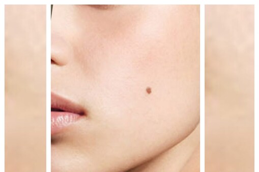 Moles: స్త్రీలకు ఇక్కడ పుట్టుమచ్చ ...