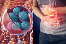 Norovirus : దేశంలో నోరో వైరస్ కలకలం.. కేరళలో 2కేసులు.. అప్రమత్తత.. లక్షణాలివే.. Norovirus : దేశంలో నోరో వైరస్ కలకలం.. కేరళలో 2కేసులు.. అప్రమత్తత.. లక్షణాలివే..