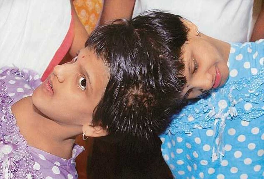  వీణ, వాణి లకు ఇప్పుడు 19 ఏళ్లు. ఇద్దరూ ఇంటర్మీడియట్ లో సీఈసీ - CEC చదివారు. వీణ 707 మార్కులు సాధిస్తే.. వాణి 712 మార్కులు సంపాదించింది. ఇద్దరూ డిస్టింక్షన్ లో ఇంటర్ పూర్తిచేయడం విశేషం.
