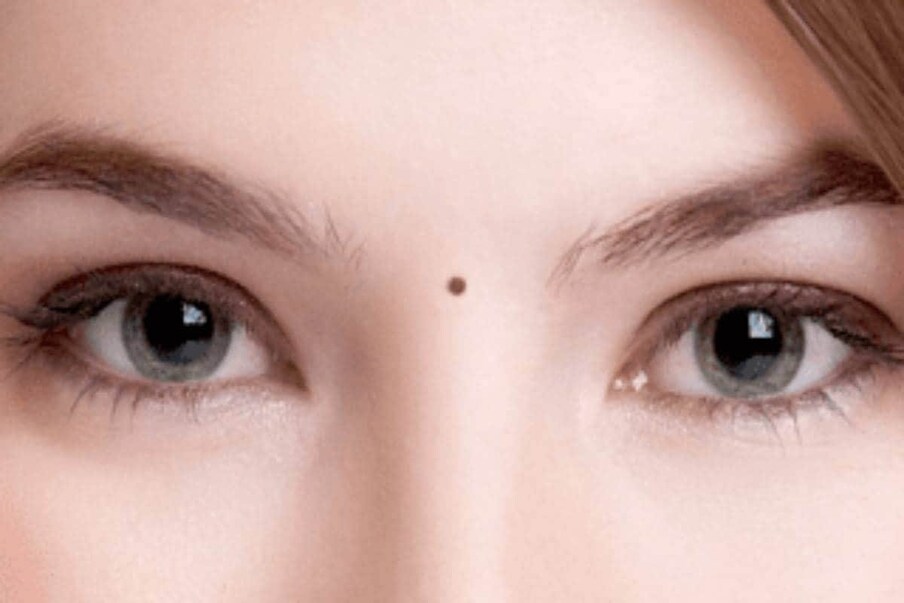 Know about the moles on woman body which will be very lucky ...