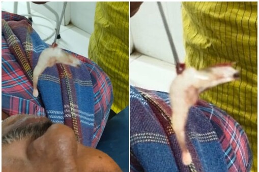 రైతు ముక్కులో దూరిన రొయ్య