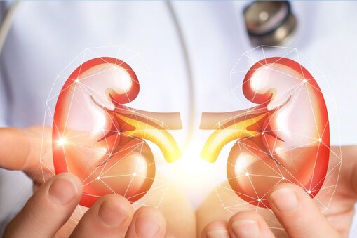 Kidney Transplant