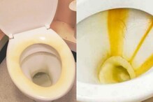 Toilet seat cleaning : టాయిలెట్ సీట్ లో పసుపు మరకలు పోలేదా? ఇలా చేస్తే ఈజీగా పోతాయ్