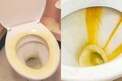 Toilet seat cleaning : టాయిలెట్ సీట్ లో పసుపు మరకలు పోలేదా? ఇలా చేస్తే ఈజీగా పోతాయ్