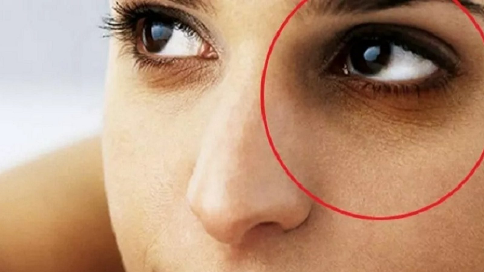 Dark Circles కళ్ల కింద డార్క్ సర్కిల్స్‌తో ఇబ్బందిగా ఉందా? ఈ ఫుడ్