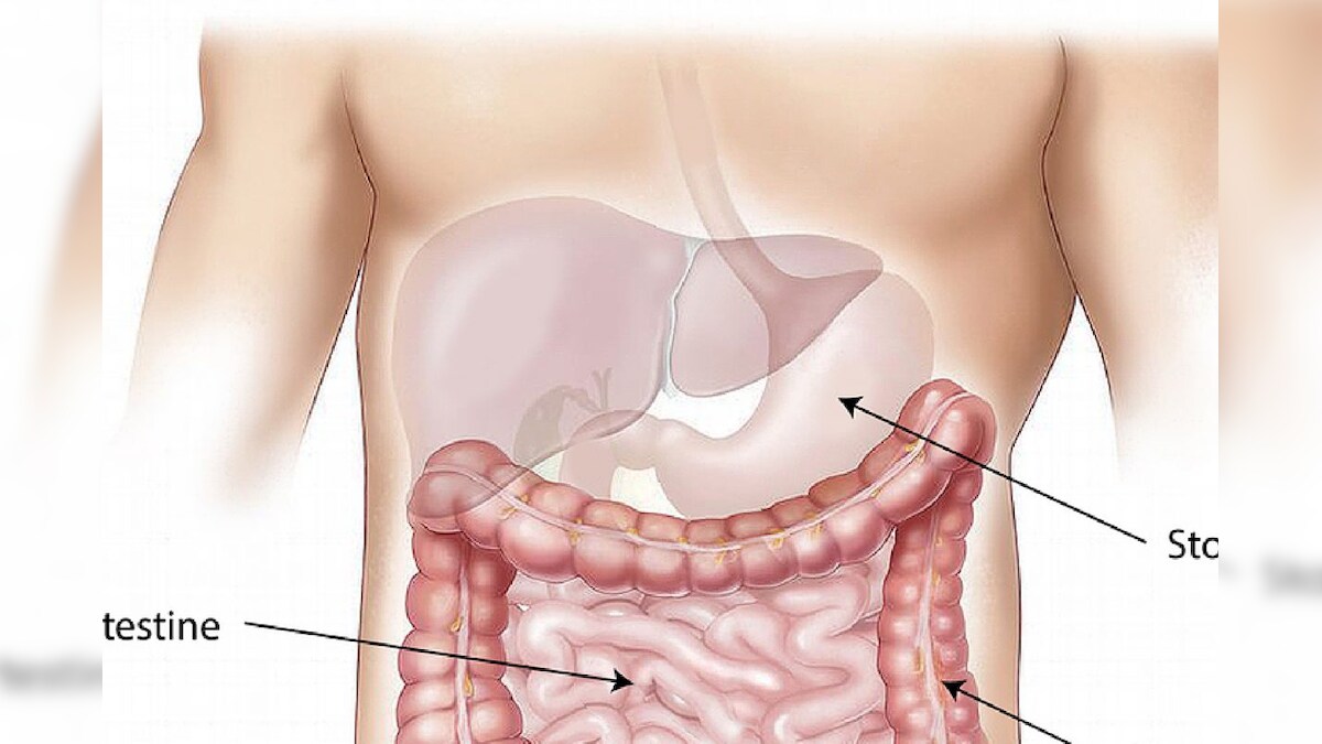 Digestion గ్యాస్, అజీర్ణ సమస్య ఉన్నవారు.. ఈ ఐదు ఫుడ్స్ అస్సలు తినకూడదు..!