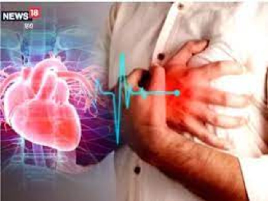  లక్షణం..,[object Object],గుండెకు సరఫరా చేసే రక్తనాళాల్లో బ్లాక్ ఏర్పడితే గుండె కండరం డ్యామేజ్ అయితే హార్ట్ అటాక్ అంటారు. హార్ట్ అటాక్ వచ్చిన తర్వాత గుండె ఆగిపోవడం, కొన్ని సార్లు కొట్టుకోవడానికి కార్డియాక్ అరెస్ట్ అంటారు.దీంతో గుండె చాలా వీక్ అయిపోతుంది. దీంతో ప్రాణాపాయం ఏర్పడుతుంది. దీని తర్వాత కార్డియో జెనిక్ షాక్ కూడా రావచ్చు. ఇది బ్రెయిన్, కిడ్నీ, లివర్ ఇతర అవయవాలపై కూడా ప్రభావం చూపుతుంది. దీనికి ఎక్మో చికిత్స కూడా అందిస్తారు.