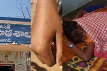 Telangana : తండాలో కలకలం.. విద్యార్థినికి మత్తు ఇంజెక్షన్.. ఇచ్చిన మహిళ ఎవరు?