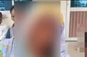 Brutally beaten: దుస్తులు లాగేసి.. చెట్టుకు కట్టేసి.. జుట్టు పీకేసి.. తాలిబన్ల తరహాలో దాడి