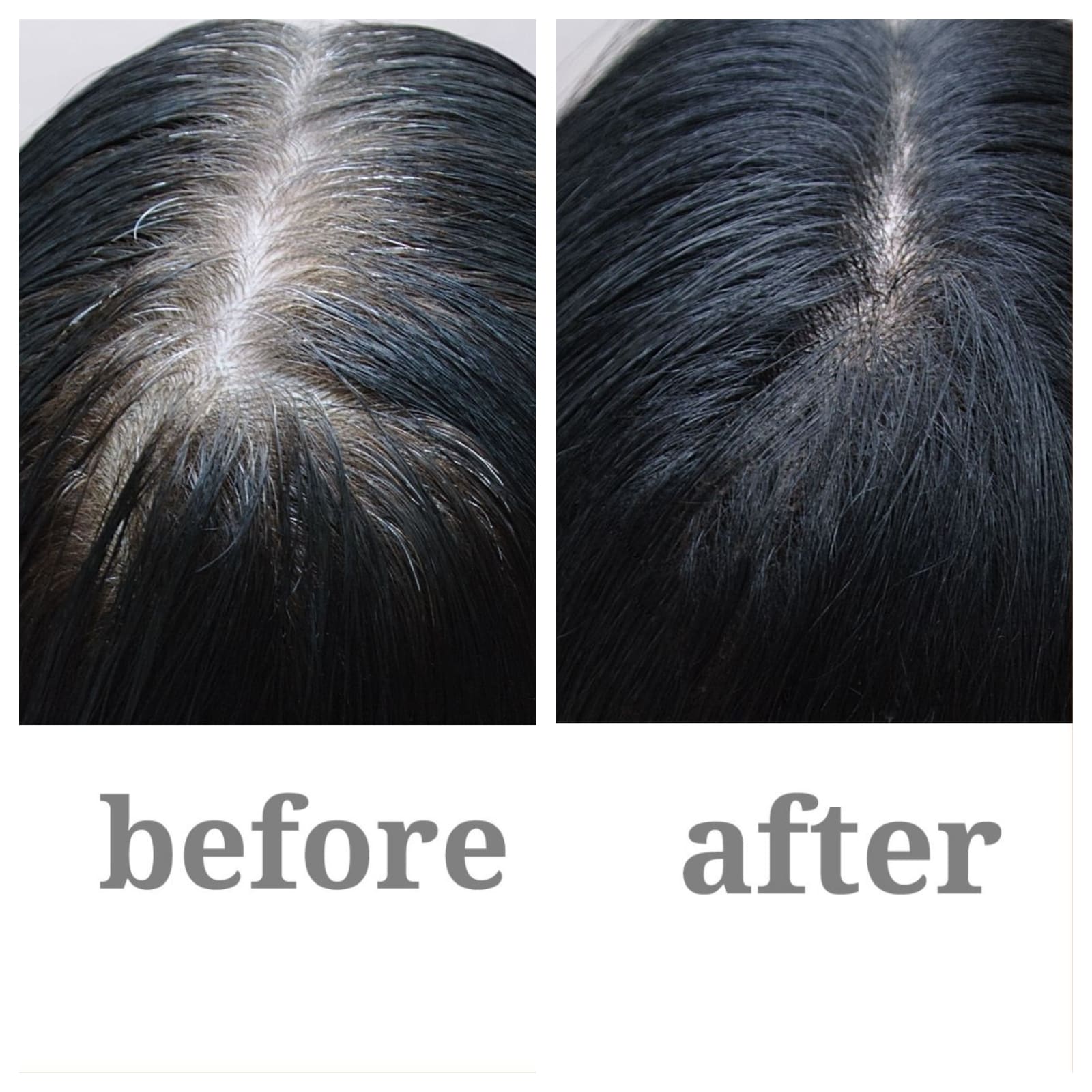 Grey Hair to Natural Color Permanently in 40 Days  Health