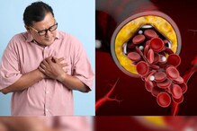 Heart problem: 66% భారతీయుల గుండె జబ్బులకు ఇదే కారణమా? షాకింగ్ స్టడీ..!