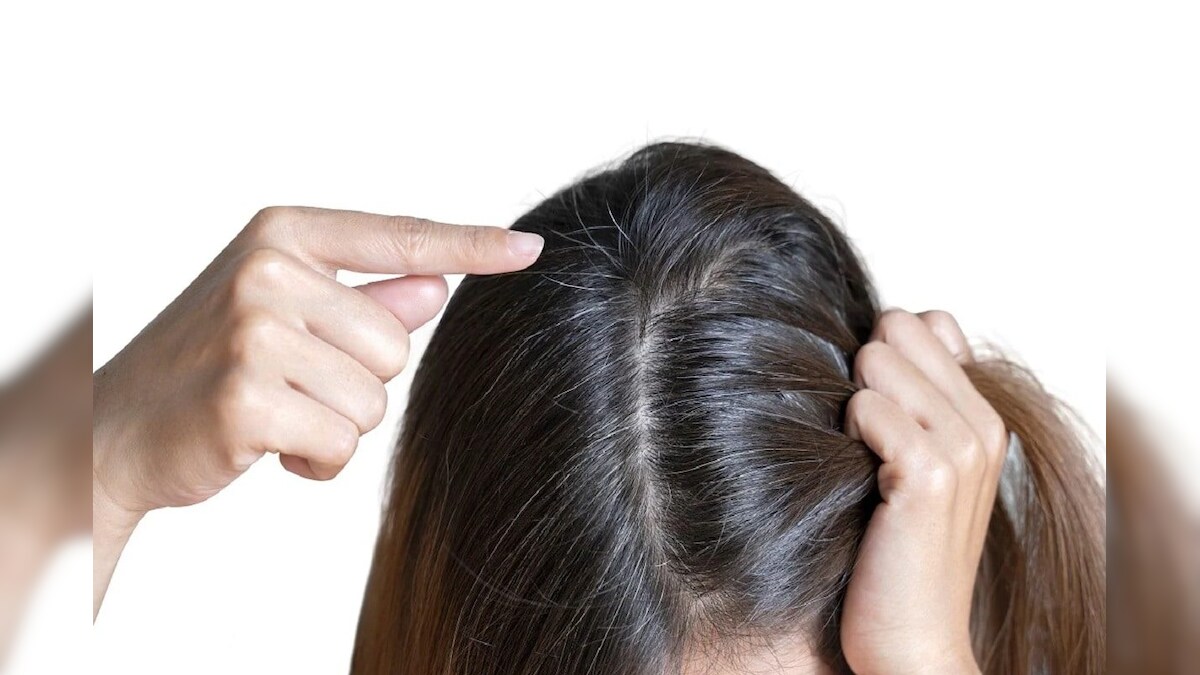 Hair Care నువ్వులనూనెతో సింపుల్ గా ఈ ఒక్కటి కలిపి అప్లై చేయండి.. తెల్ల