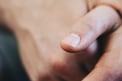 Nails: గోళ్ళపై తెల్లని మచ్చలు ఎందుకు కనిపిస్తాయి? కారణం తెలిస్తే షాక్ అవుతారు