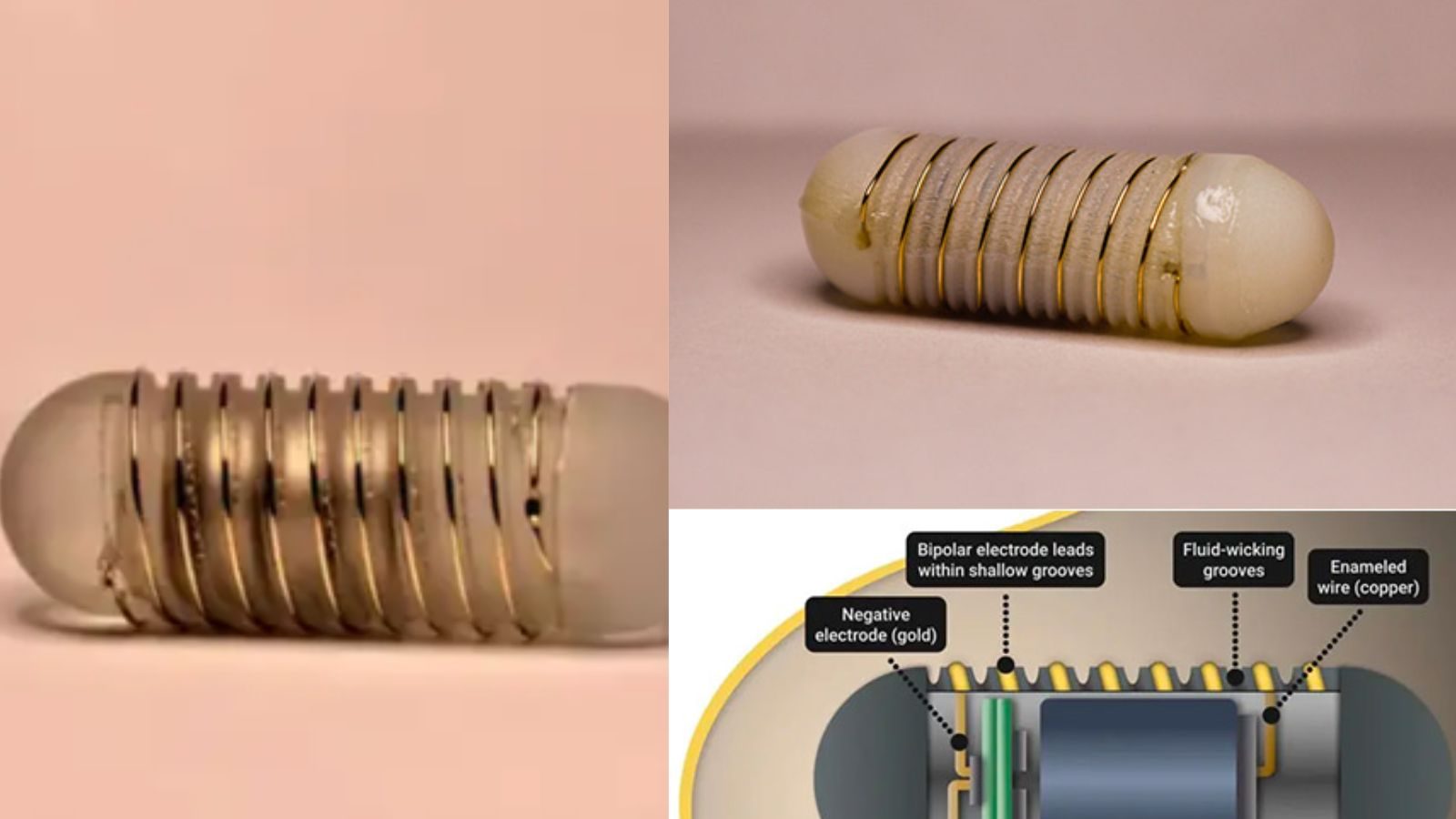 Flash Capsule FLASH: వైద్య చరిత్రలో మరో సరికొత్త ఆవిష్కరణ..ఆకలిని నియంత్రించే ...
