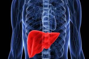 Liver Care: మీ కాలేయం దెబ్బతినకుండా ఉండాలంటే.. వీటికి దూరంగా ఉండటం బెటర్