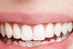 Lucky Teeth: మీ పళ్లు ఈ ఆకారంలో ఉంటే మీఅంత అదృష్టవంతులు మరొకరు ఉండరు