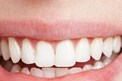 Lucky Teeth: మీ పళ్లు ఈ ఆకారంలో ఉంటే మీఅంత అదృష్టవంతులు మరొకరు ఉండరు