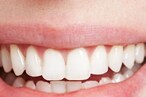 Lucky Teeth: మీ పళ్లు ఈ ఆకారంలో ఉంటే మీఅంత అదృష్టవంతులు మరొకరు ఉండరు